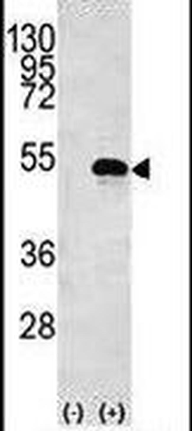 Creatine Kinase BB Antibody in Western Blot (WB)