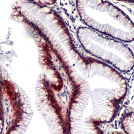 Cripto Antibody in Immunohistochemistry (IHC)