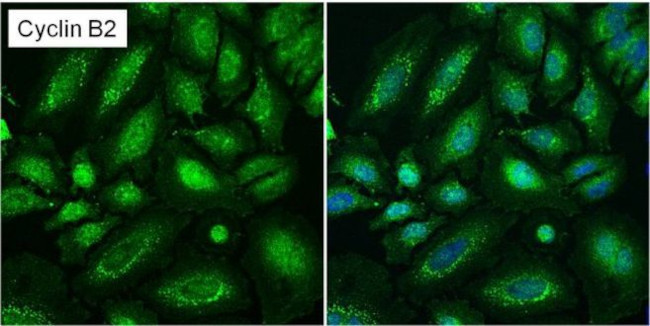 Cyclin B2 Antibody in Immunocytochemistry (ICC/IF)