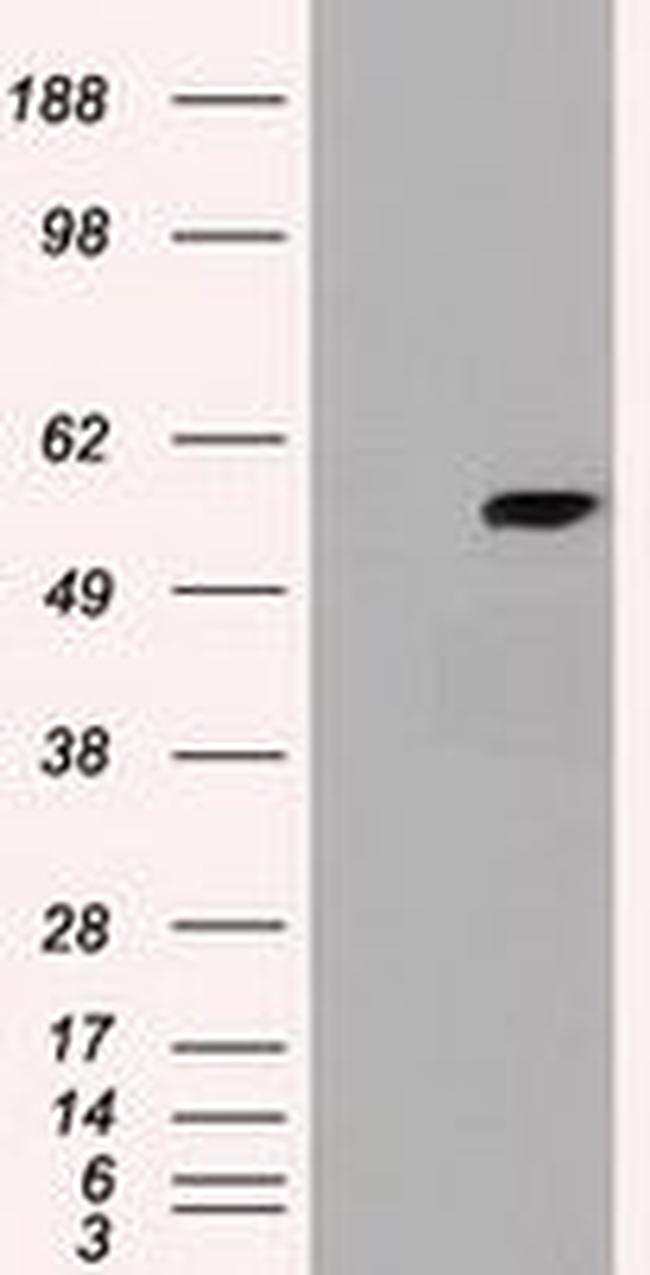 Cyp7b1 Antibody in Western Blot (WB)