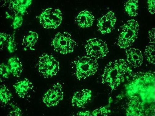 Cytokeratin 18 Antibody in Immunohistochemistry (Frozen) (IHC (F))