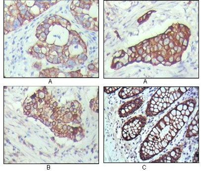 Cytokeratin 19 Antibody in Immunohistochemistry (Paraffin) (IHC (P))