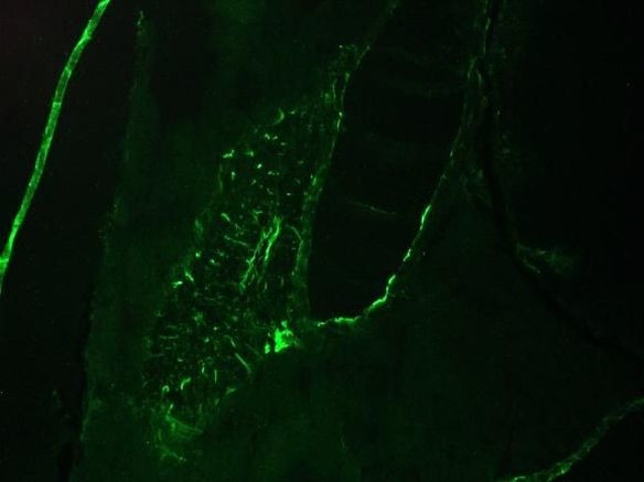 Cytokeratin 8 Antibody in Immunohistochemistry (IHC)