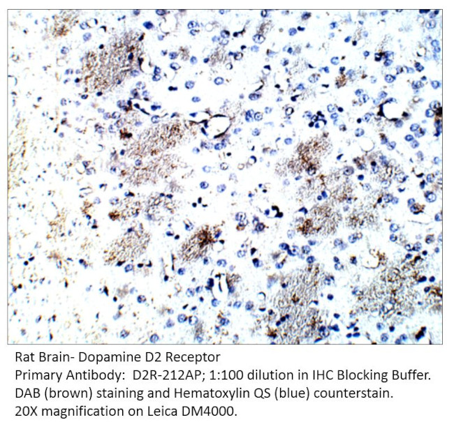 Dopamine D2 Receptor Antibody in Immunohistochemistry (IHC)