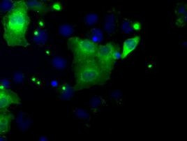 DAPK2 Antibody in Immunocytochemistry (ICC/IF)