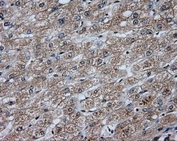 DAPK2 Antibody in Immunohistochemistry (Paraffin) (IHC (P))