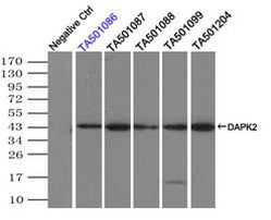 DAPK2 Antibody in Immunoprecipitation (IP)