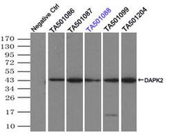 DAPK2 Antibody in Immunoprecipitation (IP)