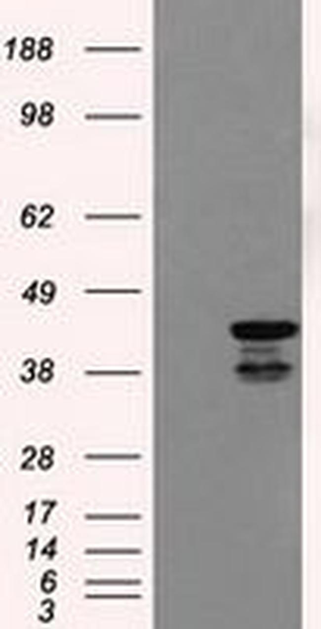 DAPK2 Antibody in Western Blot (WB)