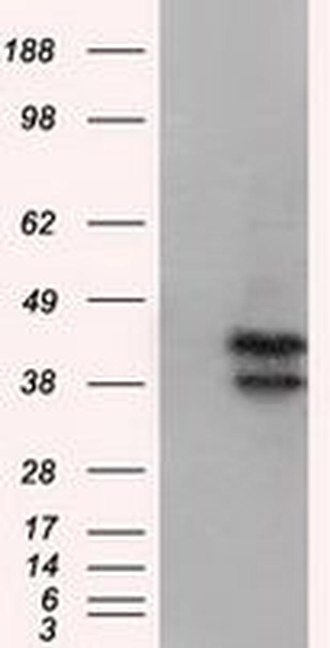 DAPK2 Antibody in Western Blot (WB)