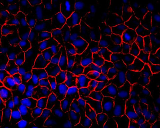 Rabbit IgG (H+L) Highly Cross-Adsorbed Secondary Antibody in Immunocytochemistry (ICC/IF)