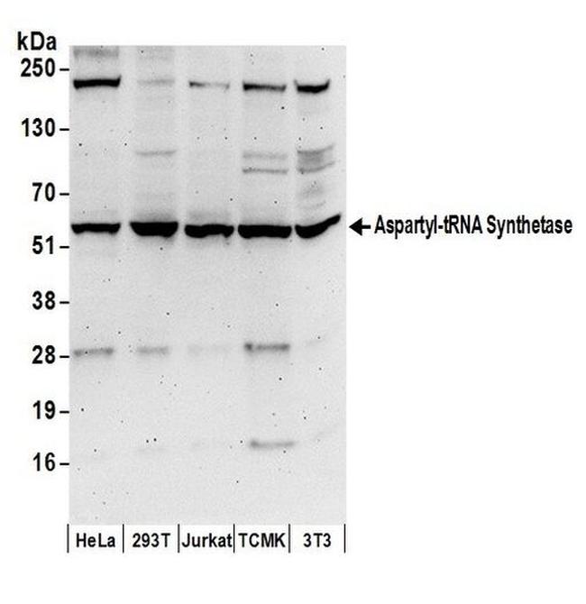 Aspartyl-tRNA Synthetase/DARS Antibody in Western Blot (WB)