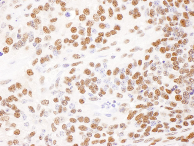 DBC1/p30 DBC Antibody in Immunohistochemistry (IHC)