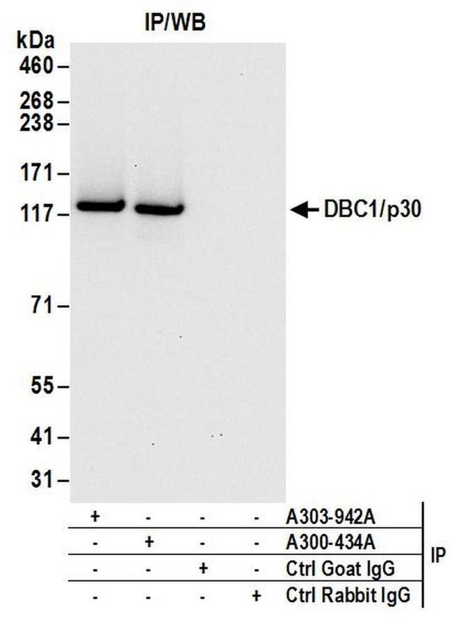 DBC1/p30 DBC Antibody in Western Blot (WB)