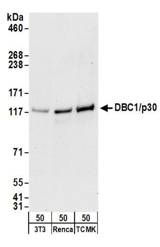 DBC1/p30 DBC Antibody in Western Blot (WB)