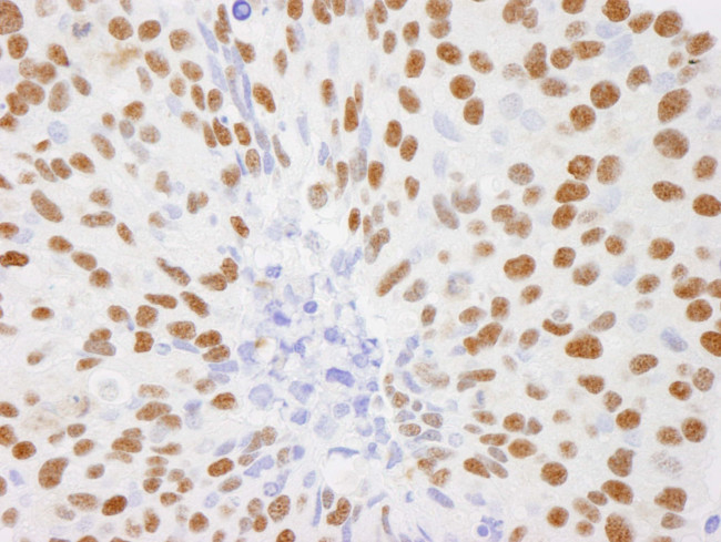 DBC1/p30 DBC Antibody in Immunohistochemistry (IHC)