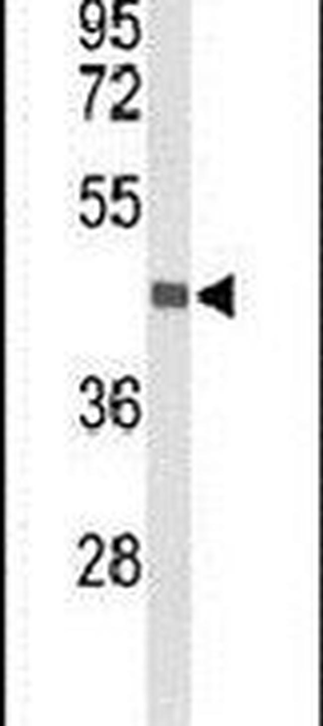 BRINP1 Antibody in Western Blot (WB)