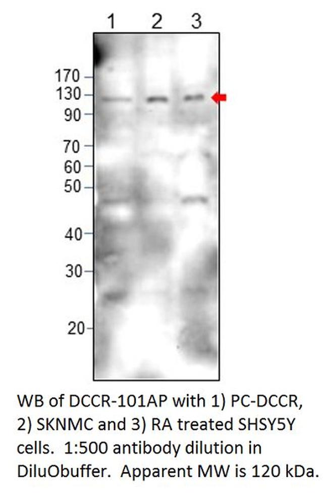 DCC Antibody in Western Blot (WB)