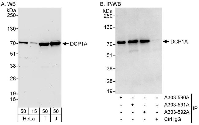 DCP1A Antibody in Western Blot (WB)