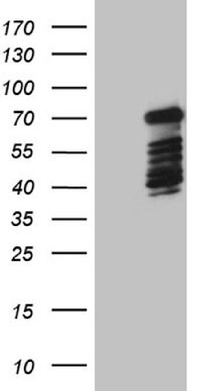 DCP1B Antibody in Western Blot (WB)