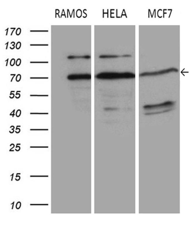 DCP1B Antibody in Western Blot (WB)