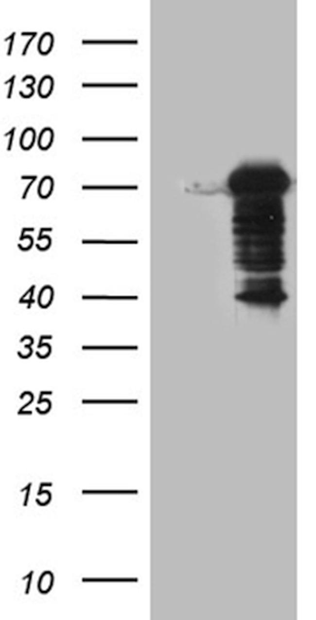 DCP1B Antibody in Western Blot (WB)