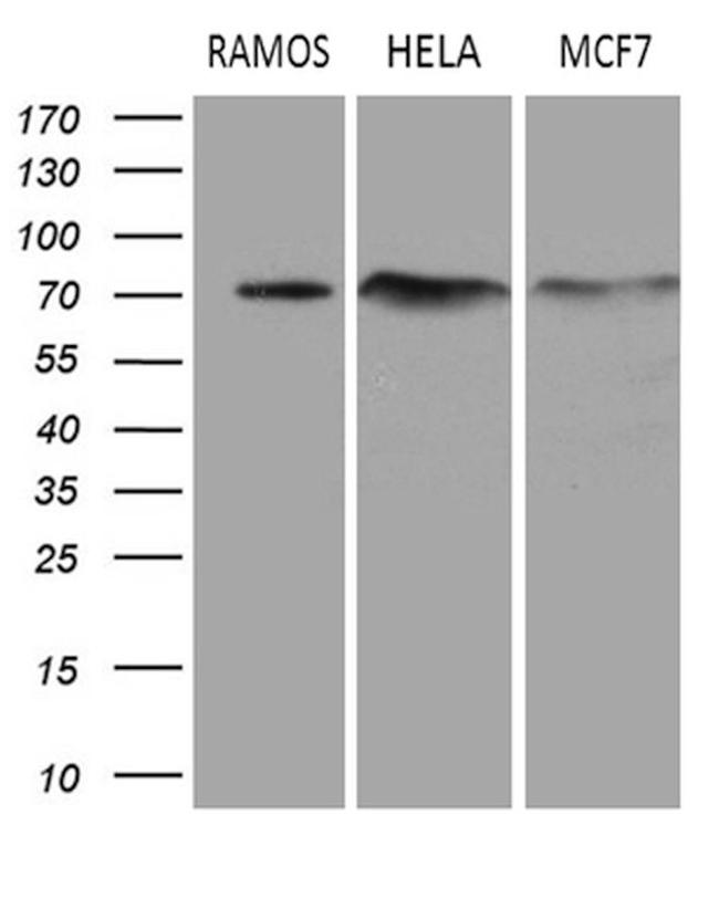 DCP1B Antibody in Western Blot (WB)