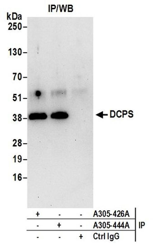 DCPS Antibody in Western Blot (WB)