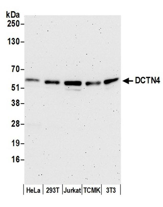 DCTN4/Dynactin p62 Antibody in Western Blot (WB)