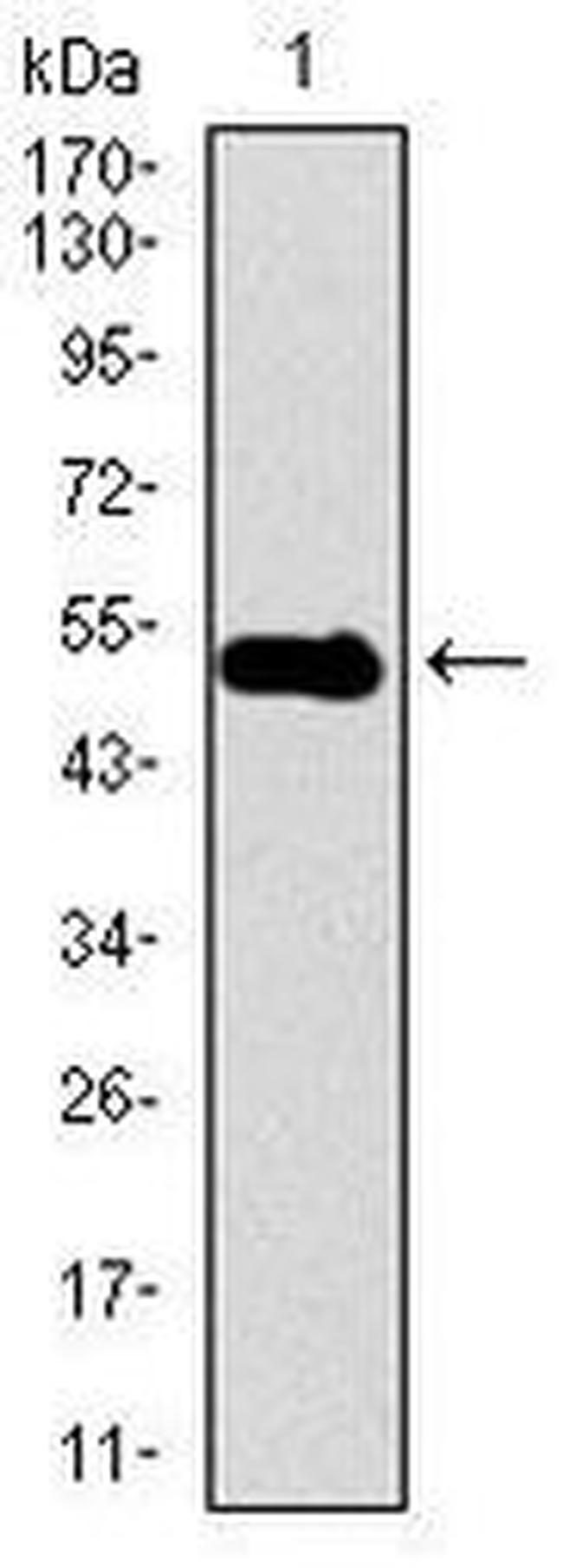 Dynactin 4 Antibody in Western Blot (WB)