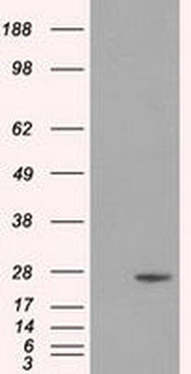 DCXR Antibody in Western Blot (WB)