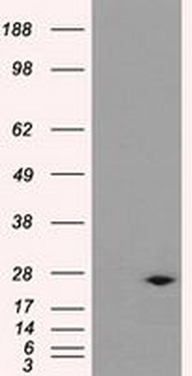 DCXR Antibody in Western Blot (WB)