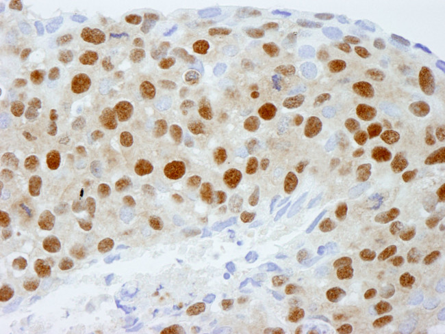 DDB1 Antibody in Immunohistochemistry (IHC)