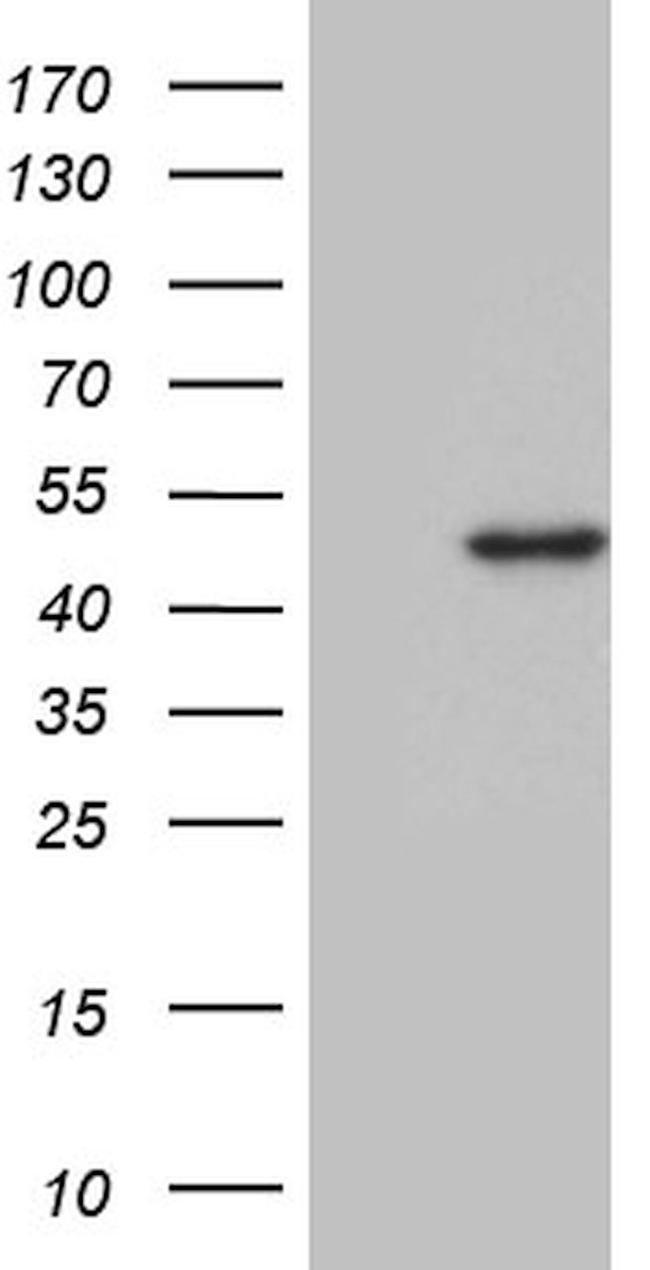 DDB2 Antibody in Western Blot (WB)