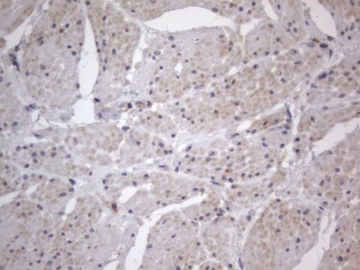 DDOST Antibody in Immunohistochemistry (Paraffin) (IHC (P))