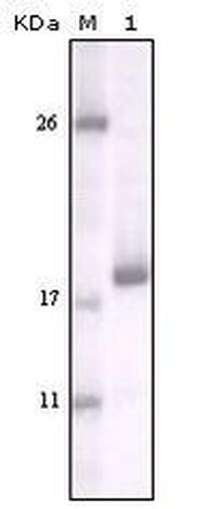 DDR2 Antibody in Western Blot (WB)