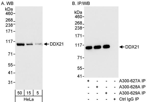 DDX21 Antibody in Western Blot (WB)