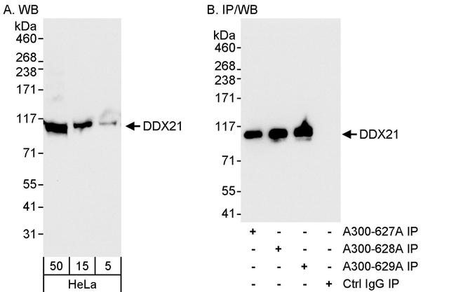 DDX21 Antibody in Western Blot (WB)