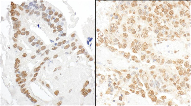 DDX27 Antibody in Immunohistochemistry (IHC)