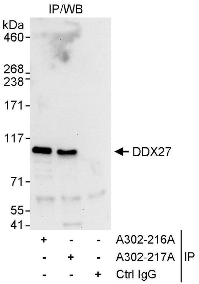 DDX27 Antibody in Immunoprecipitation (IP)