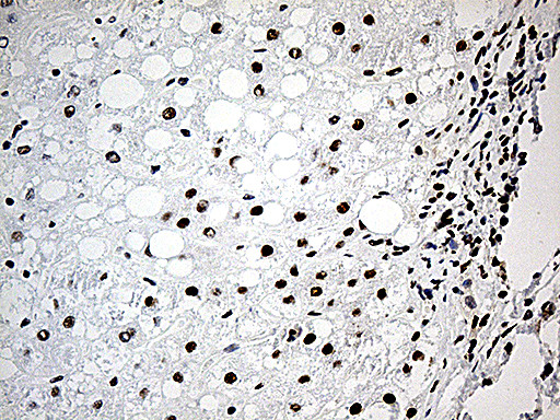 DDX39B Antibody in Immunohistochemistry (Paraffin) (IHC (P))