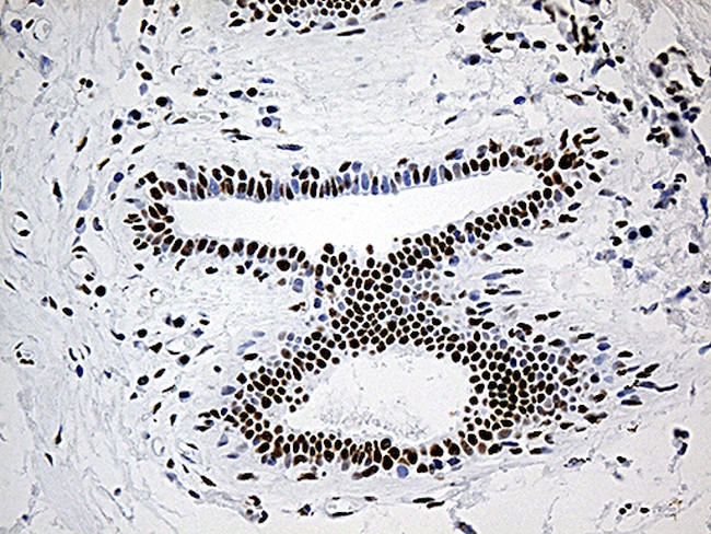 DDX39B Antibody in Immunohistochemistry (Paraffin) (IHC (P))