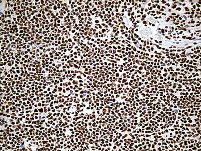 DDX39B Antibody in Immunohistochemistry (Paraffin) (IHC (P))