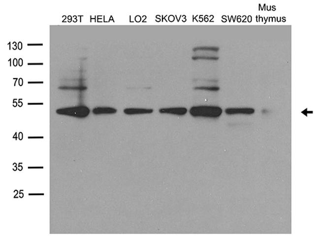 DDX39B Antibody in Western Blot (WB)