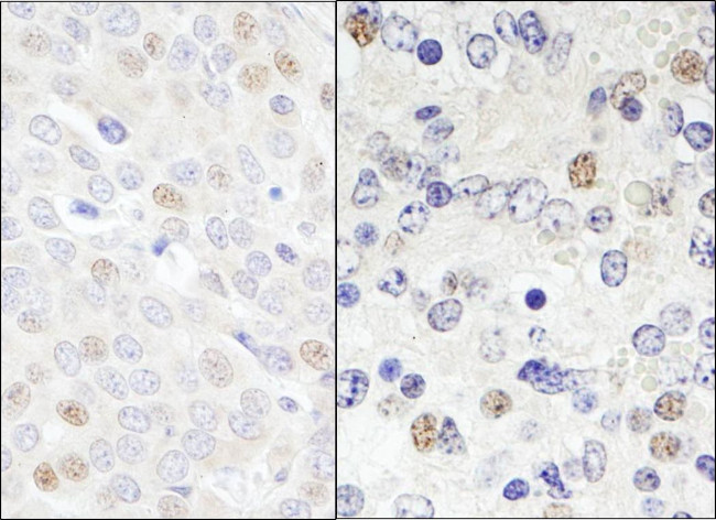 DDX46 Antibody in Immunohistochemistry (IHC)