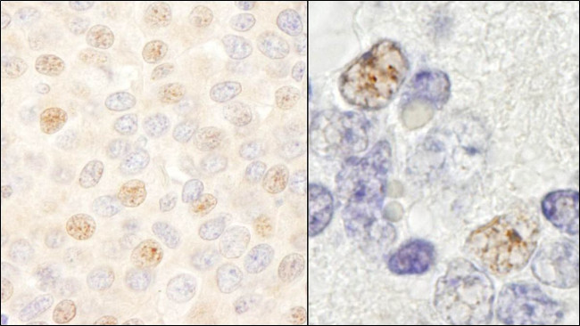 DDX46 Antibody in Immunohistochemistry (IHC)