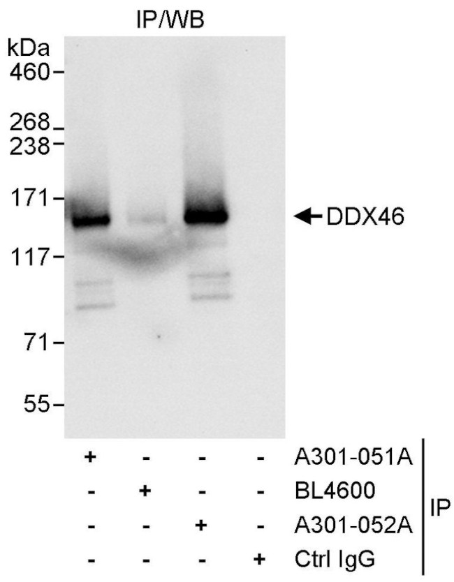 DDX46 Antibody in Immunoprecipitation (IP)