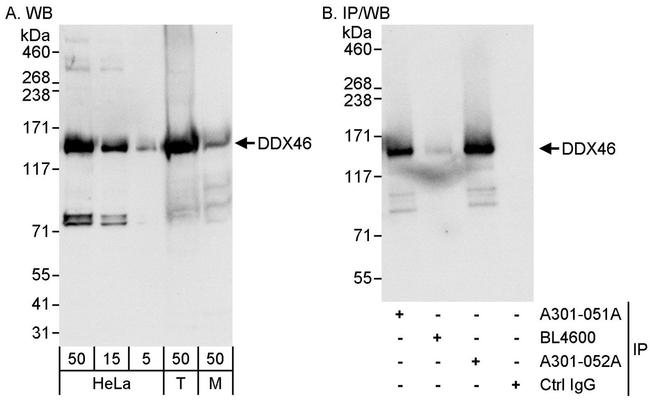 DDX46 Antibody in Western Blot (WB)