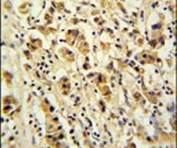 DDX49 Antibody in Immunohistochemistry (IHC)