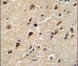 DDX5 Antibody in Immunohistochemistry (IHC)